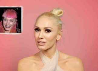 Celebrity Dental Costs Revealed: What Stars Pay for Dental Work – Apple Daily news-29082024-013019