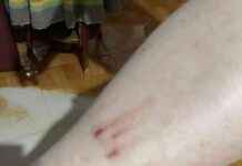 Three people injured in falls on escalator at Hualien Train Station – Complaints about malfunctioning handrail – Life – Liberty Times E-paper three-people-injured-in-falls-on-escalator-at-hualien-train-station-complaints-about-malfunctioning-handrail-life-liberty-times-e-paper