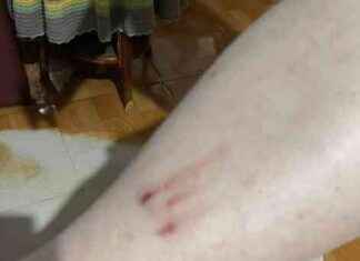 Three people injured in falls on escalator at Hualien Train Station – Complaints about malfunctioning handrail – Life – Liberty Times E-paper three-people-injured-in-falls-on-escalator-at-hualien-train-station-complaints-about-malfunctioning-handrail-life-liberty-times-e-paper